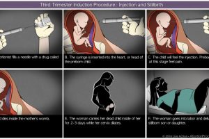 Third-Trimester-induction-diagram